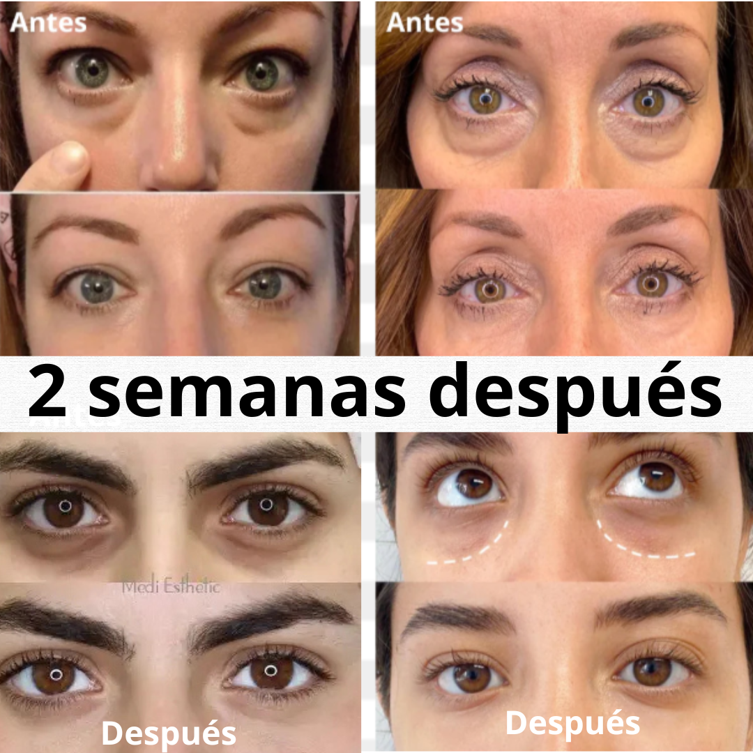 Sérum Anti Ojeras Velora | Contorno de Ojos Reafirmante e Hidratante