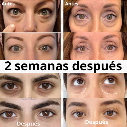 Sérum Anti Ojeras Velora | Contorno de Ojos Reafirmante e Hidratante